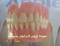دندان مصنوعی سیصد