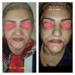 کلینیک تخصصی پوست مو زیبایی دکتر حمید مشگی