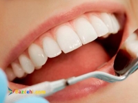 ✔️متخصص دندانپزشکی ترمیمی و زیبایی | بهترین کلینیک تخصصی دندانپزشکی تهران